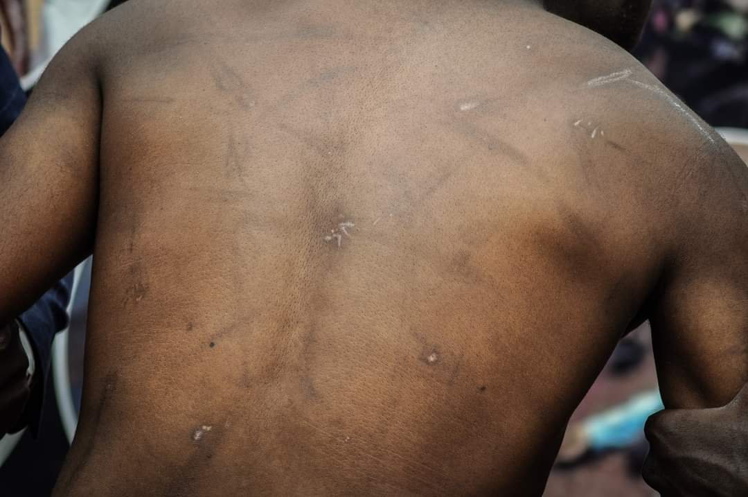 GRAPHIC! Kasese NUP Coordinator Reveals Gory Details Of Torture In Detention