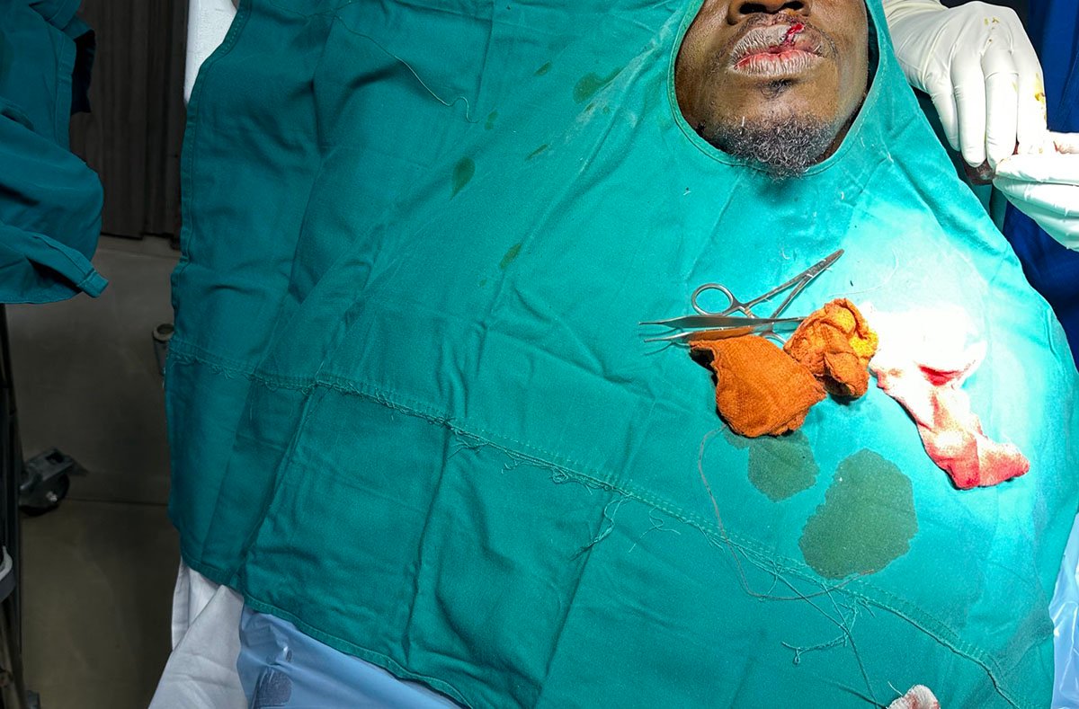 No More Kissing Sheila Gashumba — Grenade Offical Chops Rickman’s Lips